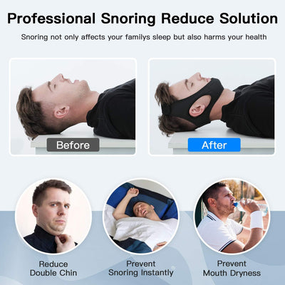 Anti-Snoring Chin Strap – Comfortable and Adjustable Sleep Solution